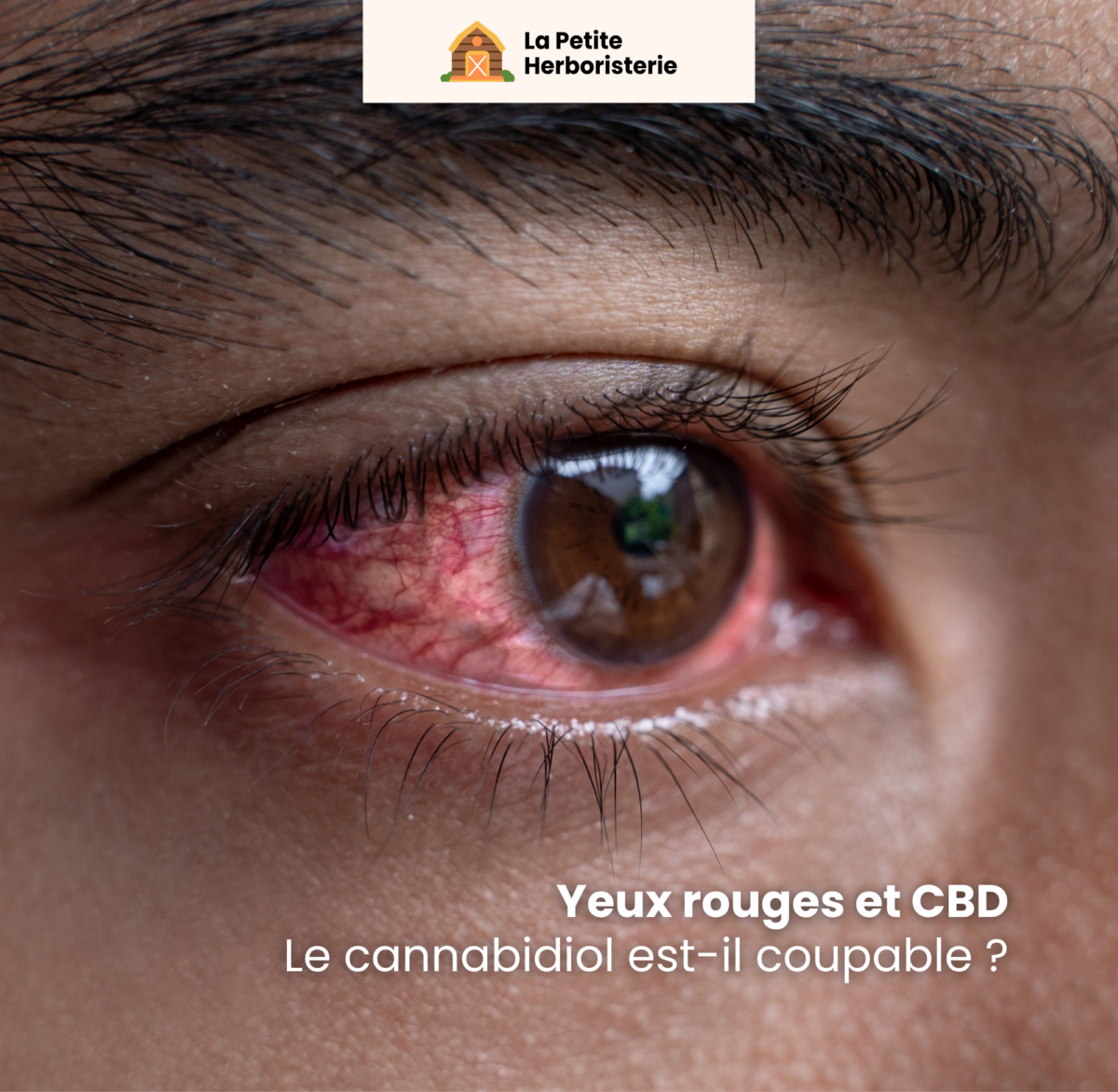 CBD yeux rouges, CBD yeux secs, CBD irritation oculaire, CBD effets yeux
